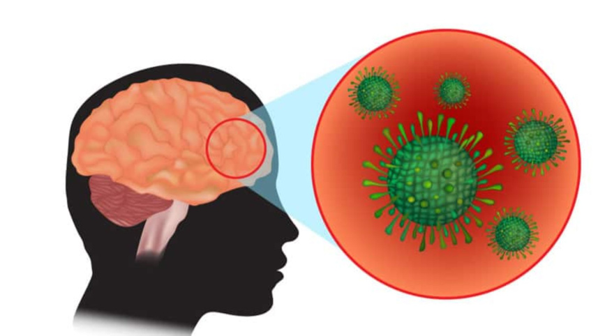 মেনিনজাইটিস: ঝুঁকি, কারণ ও সতর্কতা